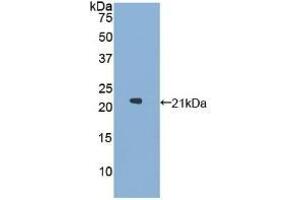 Detection of Recombinant GaA, Human using Polyclonal Antibody to Glucosidase Alpha, Acid (GaA) (GAA 抗体  (AA 595-770))