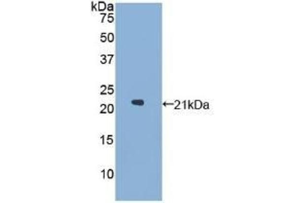 GAA 抗体  (AA 595-770)