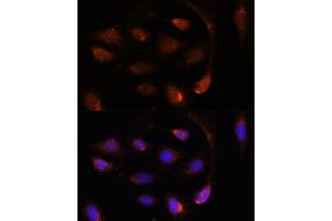 Immunofluorescence analysis of U-2 OS cells using SH3BGRL antibody (ABIN7270277) at dilution of 1:100. (SH3BGRL 抗体  (AA 1-114))