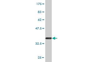 Western Blot detection against Immunogen (36. (NAGLU 抗体  (AA 644-742))