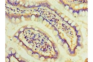 Immunohistochemistry of paraffin-embedded human small intestine tissue using ABIN7149484 at dilution of 1:100 (DAND5 抗体  (AA 23-189))