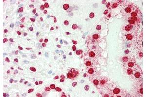 Rabbit Anti-SMARCE1 antibody Catalog Number: ARP33313 Formalin Fixed Paraffin Embedded Tissue: Human Kidney Primary antibody Concentration: 1:100 Secondary Antibody: Donkey anti-Rabbit-Cy3 Secondary Antibody Concentration: 1:200 Magnification: 20x Exposure Time: 0. (SMARCE1 抗体  (N-Term))