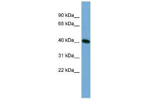 WB Suggested Anti-TSSK2 Antibody Titration: 0. (TSSK2 抗体  (Middle Region))