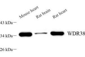 Western blot analysis of WDR38 (ABIN7076218) at dilution of 1: 2000 (WDR38 抗体)