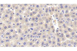 Immunohistochemistry (IHC) image for anti-Sulfotransferase Family, Cytosolic, 1A, Phenol-Preferring, Member 1 (SULT1A1) (AA 3-291) antibody (ABIN7437887)