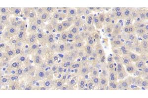 Detection of SULT1A1 in Rat Liver Tissue using Polyclonal Antibody to Sulfotransferase 1A1 (SULT1A1) (SULT1A1 抗体  (AA 3-291))