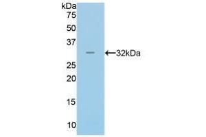 Western Blotting (WB) image for anti-Myosin (AA 1069-1331) antibody (ABIN7439273)