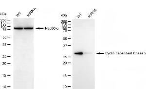 Western blotting analysis using cyclin dependent kinase 5 antibody (ABIN7798216). (CDK5 抗体)