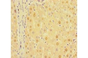 Immunohistochemistry of paraffin-embedded human liver tissue using ABIN7154596 at dilution of 1:100 (RIT1 抗体  (AA 1-219))