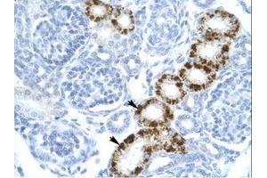 Image no. 1 for anti-Eukaryotic Translation Initiation Factor 2-alpha Kinase 2 (EIF2AK2) (C-Term) antibody (ABIN6735902) (EIF2AK2 抗体  (C-Term))