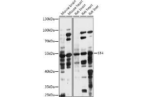 Western blot analysis of extracts of various cell lines, using 5T4 antibody (ABIN7271010) at 1:1000 dilution. (TPBG 抗体  (AA 32-350))