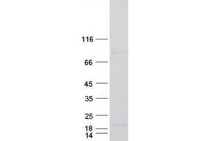 Western Blotting (WB) image for Adaptor-Related Protein Complex 2, sigma 1 Subunit (AP2S1) protein (Myc-DYKDDDDK Tag) (ABIN2714770)