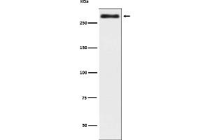 Western blot analysis of Talin 2 in expression HeLa cell lysate.