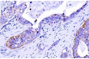 IHC analysis of Claudin 7/CLDN-7 using anti-Claudin 7/CLDN-7 antibody (ABIN7602665). (Claudin 7 抗体  (AA 92-211))