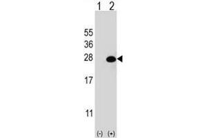 Western blot analysis of DGCR6L (arrow) using rabbit polyclonal DGCR6L Antibody (Center) . (DGCR6L 抗体  (Middle Region))