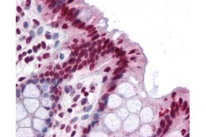 Anti-FAM59B antibody IHC of human colon. (FAM59B 抗体  (C-Term))