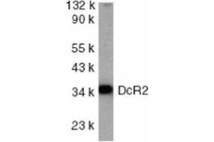 Western blot analysis of DcR2 in HeLa whole cell lysate with AP30280PU-N DcR2 antibody at 1/1000 dilution.