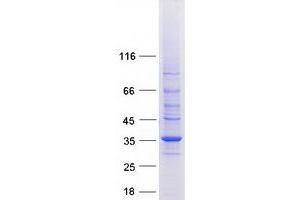 Western Blotting (WB) image for Stomatin (STOM) (Transcript Variant 1) protein (Myc-DYKDDDDK Tag) (ABIN2732891)