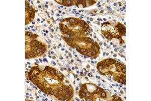 Immunohistochemistry of paraffin-embedded human stomach using TFF1 antibody. (TFF1 抗体)