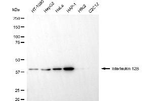 anti-Interleukin 12 beta (IL12B) antibody