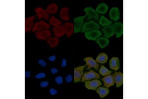 ABIN6262577 and ABIN6279542 staining Hela cells(30 min of UV treatment) by IF/ICC.