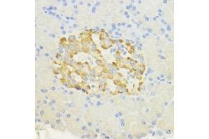 Immunohistochemistry (IHC) image for anti-Surfeit 4 (SURF4) (AA 50-150) antibody (ABIN7270650)
