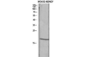 Western Blot (WB) analysis of Mouse Kidney lysis using TGFA antibody. (TGFA 抗体)
