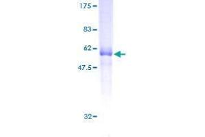 CD320 Protein (AA 1-282) (GST tag)