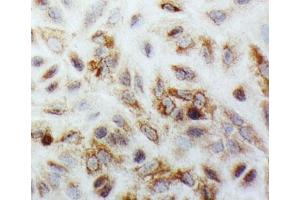 ICC testing of SMAD1 antibody and A549 cells (SMAD1 抗体  (C-Term))