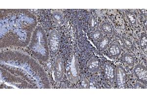 IHC analysis of SAMHD1 using anti-SAMHD1 antibody (ABIN7601514).