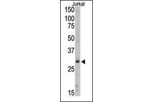 Image no. 1 for anti-Sirtuin 5 (SIRT5) (C-Term) antibody (ABIN358734) (SIRT5 抗体  (C-Term))