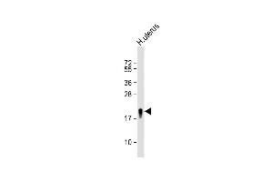Anti-TAGLN Antibody (N-term) at 1:8000 dilution + H. (Transgelin 抗体  (N-Term))