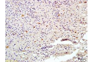 Formalin-fixed and paraffin embedded human brain labeled with Anti-HDAC6 Polyclonal Antibody, Unconjugated (ABIN681058) at 1:200 followed by conjugation to the secondary antibody and DAB staining (HDAC6 抗体  (AA 301-400))