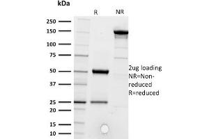 SDS-PAGE Analysis of Purified CD5 Mouse Monoclonal Antibody ABIN6383881. (CD5 抗体  (Extracellular Domain))