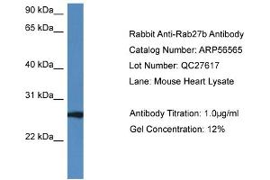 Western Blotting (WB) image for anti-RAB27B, Member RAS Oncogene Family (RAB27B) (C-Term) antibody (ABIN785819) (RAB27B 抗体  (C-Term))