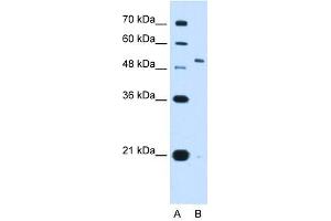 KCNC1 antibody used at 2. (KCNC1 抗体  (N-Term))