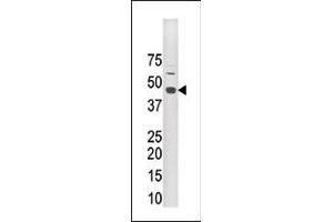 The anti-LYK5 Pab (ABIN391217 and ABIN2841293) is used in Western blot to detect LYK5 in mouse brain tissue lysate (STRADA 抗体  (N-Term))