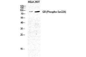 Western Blotting (WB) image for anti-GR (pSer226) antibody (ABIN3182520) (GR (pSer226) 抗体)