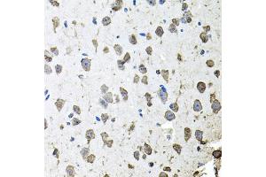 Immunohistochemistry of paraffin-embedded mouse brain using FGF1 antibody (ABIN5970259) at dilution of 1/100 (40x lens). (FGF1 抗体)