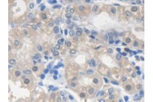 Detection of SMN2 in Human Stomach Tissue using Polyclonal Antibody to Survival Of Motor Neuron 2, Centromeric (SMN2)