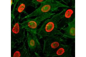 ICC/IF testing of HeLa cells treated with sodium butyrate using recombinant H3K9ac antibody (red). (Recombinant Histone 3 抗体  (acLys9))