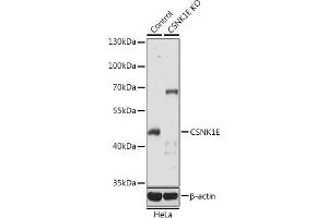 Western blot analysis of extracts from normal (control) and CSNK1E knockout (KO) HeLa cells, using CSNK1E antibody (ABIN6128970, ABIN6139116, ABIN6139117 and ABIN7101448) at 1:1000 dilution. (CK1 epsilon 抗体  (AA 247-416))