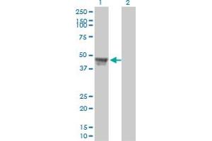 Western Blot analysis of RCC1 expression in transfected 293T cell line by RCC1 monoclonal antibody (M01), clone 2F1. (RCC1 抗体  (AA 312-421))