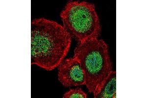 Immunofluorescence (IF) image for anti-Lymphoid Enhancer-Binding Factor 1 (LEF1) antibody (ABIN2996512) (LEF1 抗体)