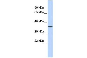 Western Blotting (WB) image for anti-Zinc Finger Protein 124 (ZNF124) antibody (ABIN2458312) (ZNF124 抗体)