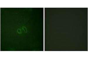 Immunofluorescence analysis of HepG2 cells, using Vinculin (Phospho-Tyr821) Antibody. (Vinculin 抗体  (pTyr821))