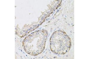 Immunohistochemistry of paraffin-embedded human prostate using CIB1 antibody. (CIB1 抗体  (AA 1-191))