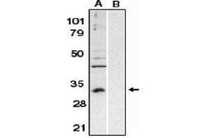 Image no. 1 for anti-B-Cell CLL/lymphoma 10 (BCL10) (AA 5-19) antibody (ABIN264992) (BCL10 抗体  (AA 5-19))