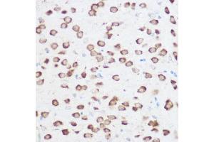 Immunohistochemistry of paraffin-embedded rat brain using RPS24 Rabbit pAb (ABIN6133032, ABIN6147213, ABIN6147214 and ABIN6215701) at dilution of 1:200 (40x lens). (RPS24 抗体  (AA 1-130))