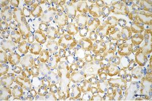 Immunohistochemistry was performed on paraffin-embedded mouse kidney using ACAT1 antibody (ABIN7797438), 1:200). (ACAT1 抗体)